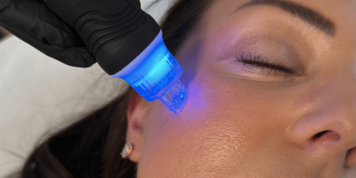 hydro glow by avenia aqua facial